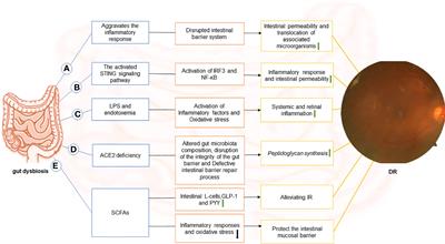 The gut-retina axis: a new perspective in the prevention and treatment of diabetic retinopathy